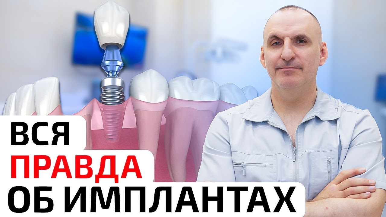 Зубные импланты: мифы, правда и реальные преимущества