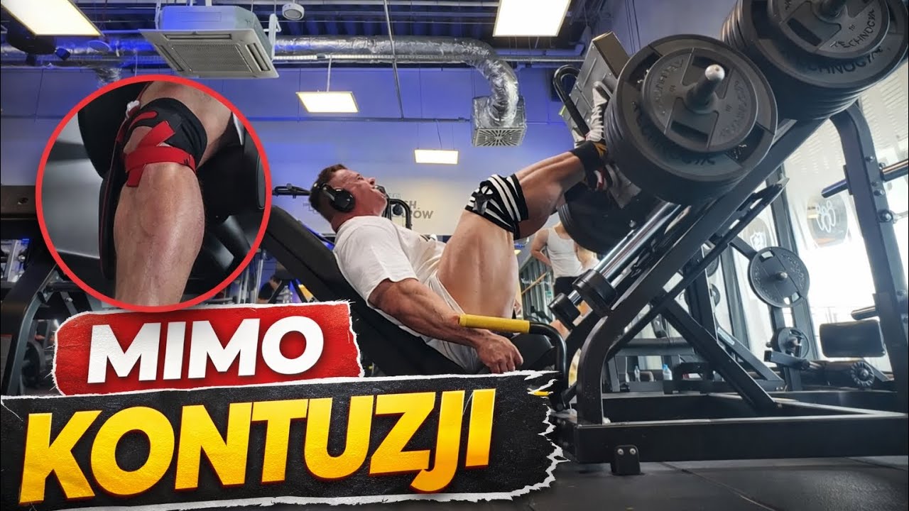 Mimo Kontuzji 
