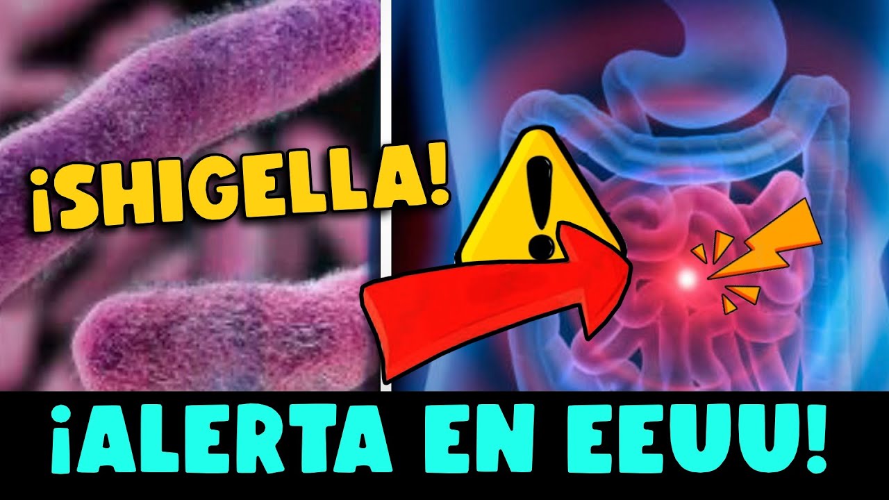 ¡CUIDADO! CDC EN EEUU ALERTA SOBRE BROTE DE SHIGELLA RESISTENTE A ANTIBIÓTICOS