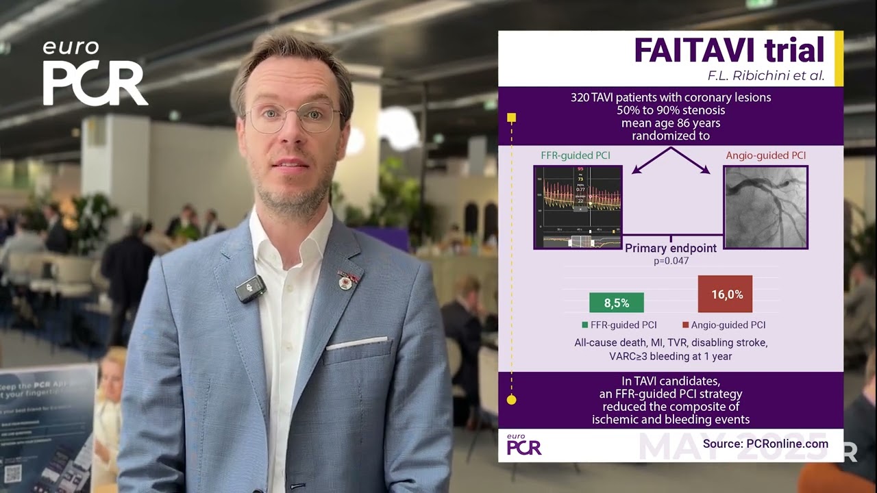 #EuroPCR 2025 LBT insights: the FAITAVI trial