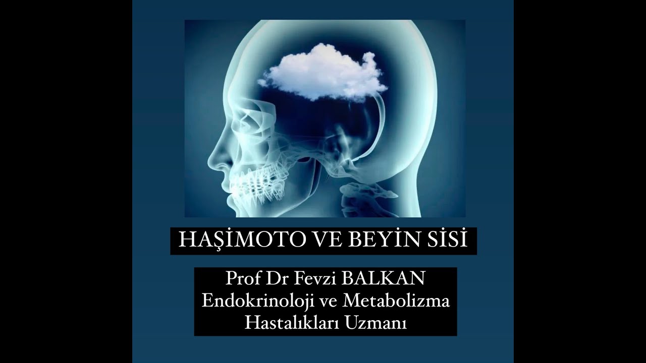 HAŞİMOTO VE BEYİN SİSİ !