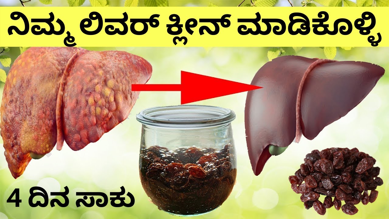 ನಿಮ್ಮ ಲಿವರ್ ಅನ್ನು ಹೀಗೆ ಕ್ಲೀನ್ ಮಾಡಿಕೊಳ್ಳಿ । 80 ಕ್ಕೂ ಹೆಚ್ಚು ರೋಗಗಳಿಂದ ತಪ್ಪಿಸಿಕೊಳ್ಳಿ Liver Detox Remedy