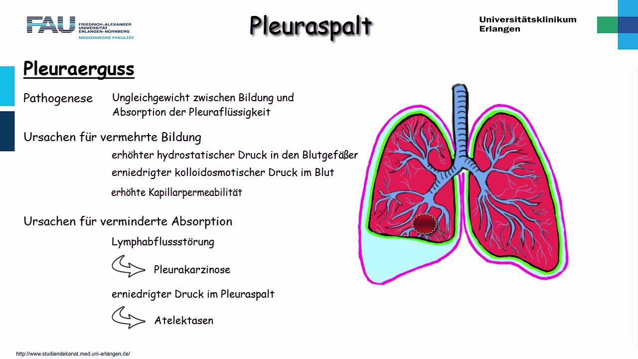 Chirurgie ─ Pleuraspalt Teil 1/2