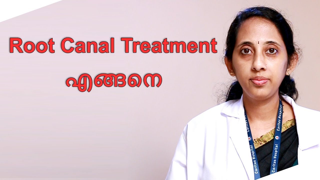 Root Canal Treatment എങ്ങനെ??? | LATEST MALAYALAM HEALTH TIPS