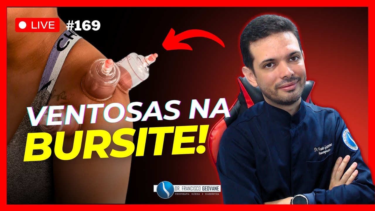 VENTOSATERAPIA - As VENTOSAS FUNCIONAM para o Tratamento da Bursite? (VOCÊ VAI SE SURPREER 😱)