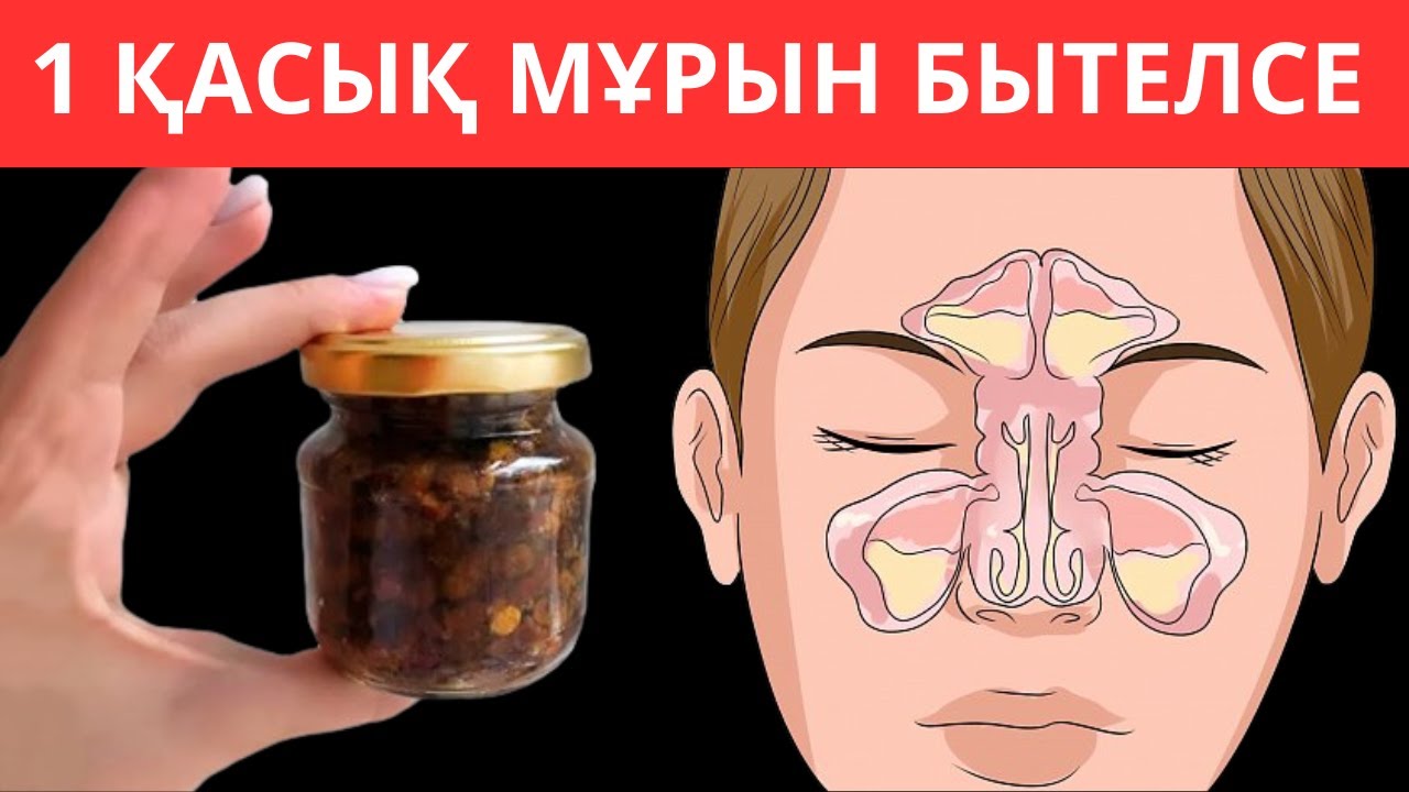 Мұрын бітелсе не істеу керек? 1 қасық мұрын бітелуін мәңгіге жоқ қылды. Бұны 99% адам білмиді