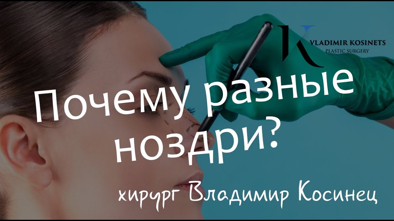 Почему разные ноздри? На вопросы отвечает пластический хирург Владимир Косинец