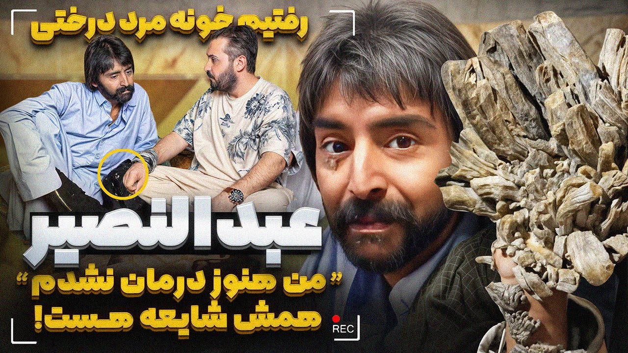 رفتیم خونه مرد درختی عبدالنصیر ❌ مستندی از مرد درختی که جای ندیدی
