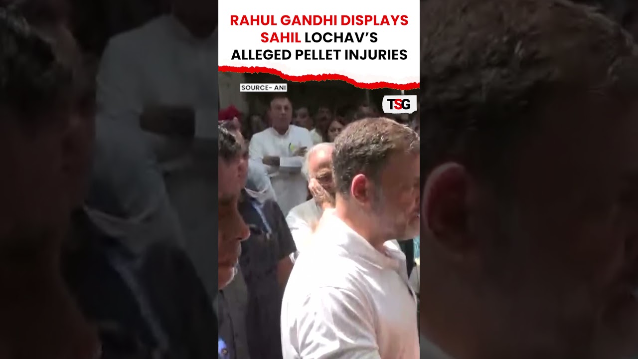 Rahul Gandhi Displays Sahil Lochav&rsquo;s Alleged Pellet Injuries | TSG