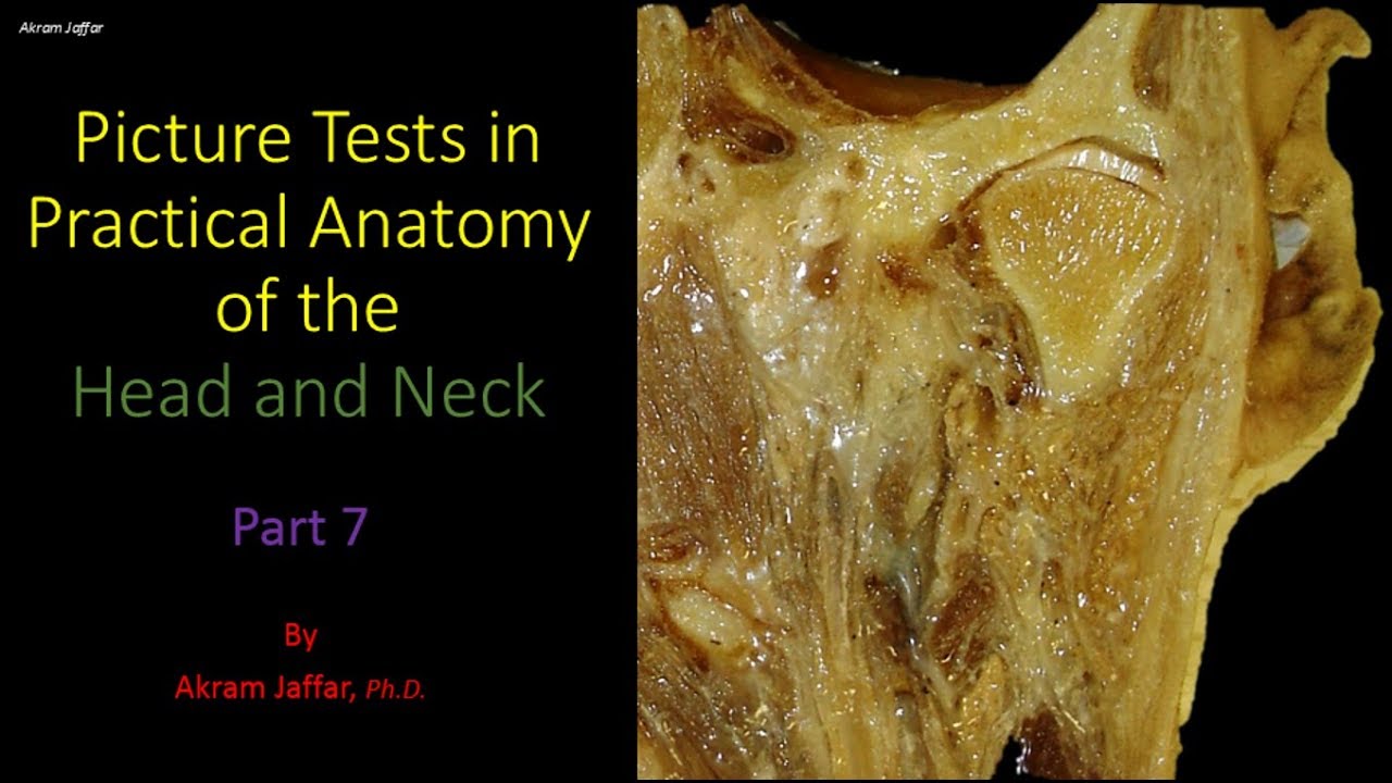 Picture tests in head and neck anatomy 7