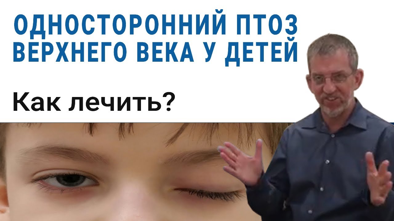 Односторонний птоз верхнего века у детей. Как и когда лечить?