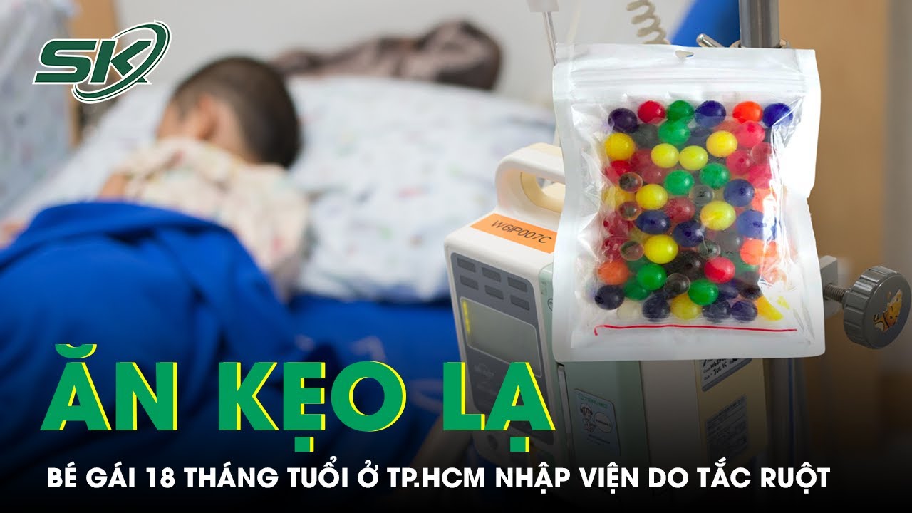 Ăn kẹo lạ, bé gái 18 tháng tuổi ở TP.HCM nhập viện do tắc ruột | SKĐS