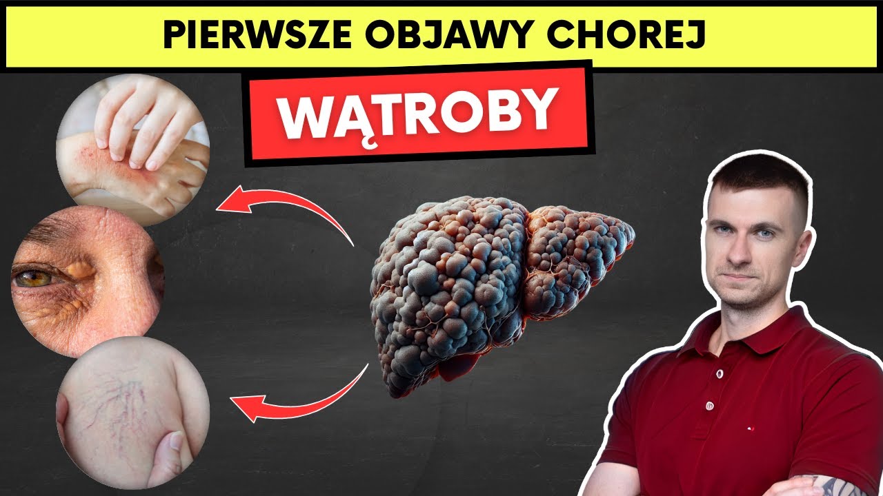 13 sygnałów chorej wątroby, których nie możesz ignorować.