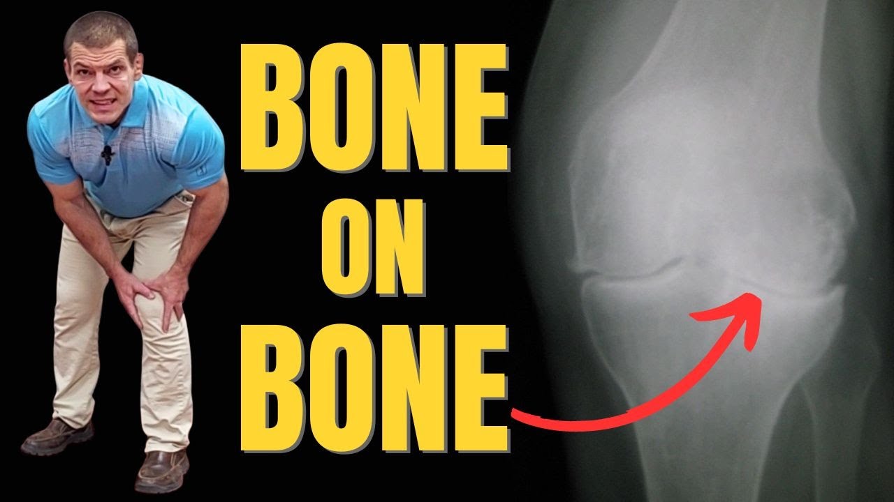Что можно сделать для облегчения боли в колене BONE on BONE? (без хирургического вмешательства)