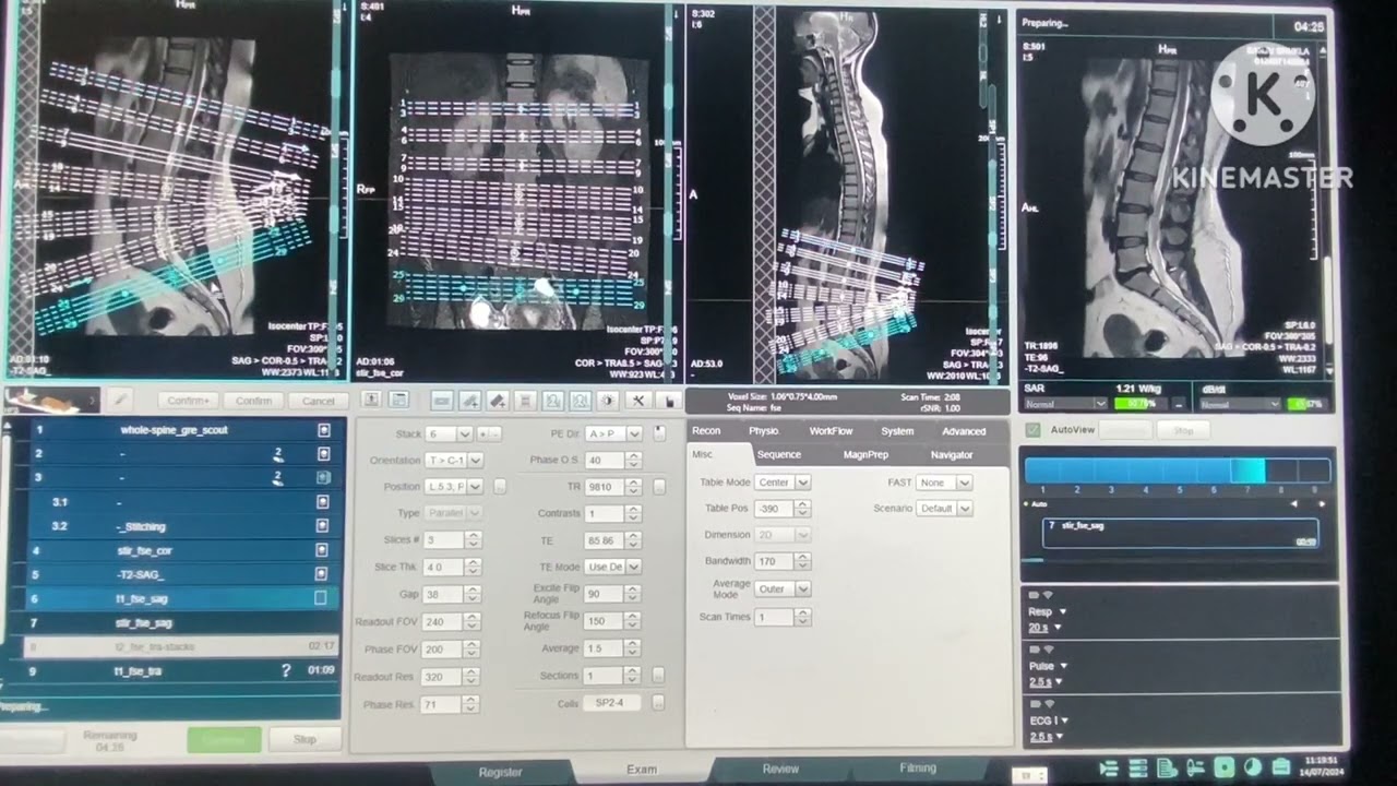MRI L/S SPINE FULL PLANNING WITH FILMING UNITED IMAGING MRI MACHINE