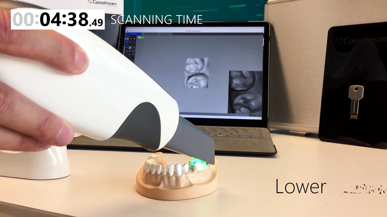 CS 3500 Real-Time Full Arch Scan | Streamhealth Dental