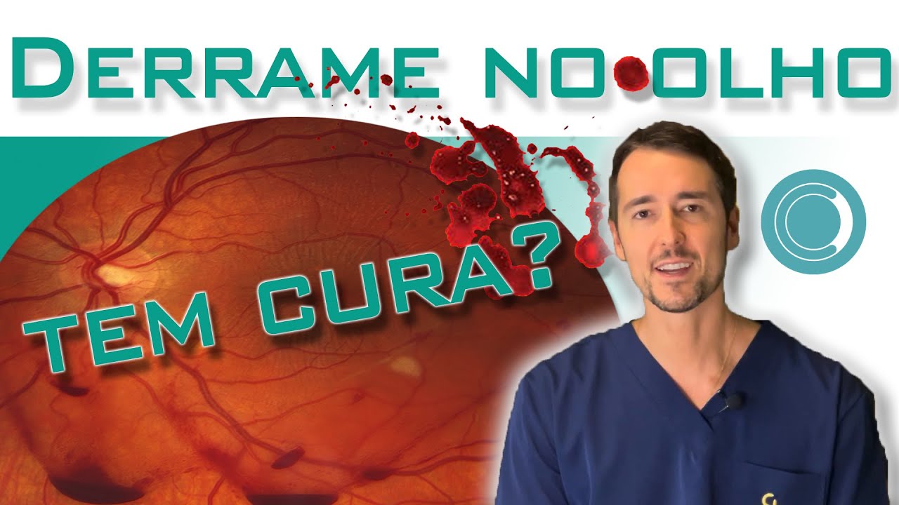 Trombose na retina (derrame no olho) tem cura?