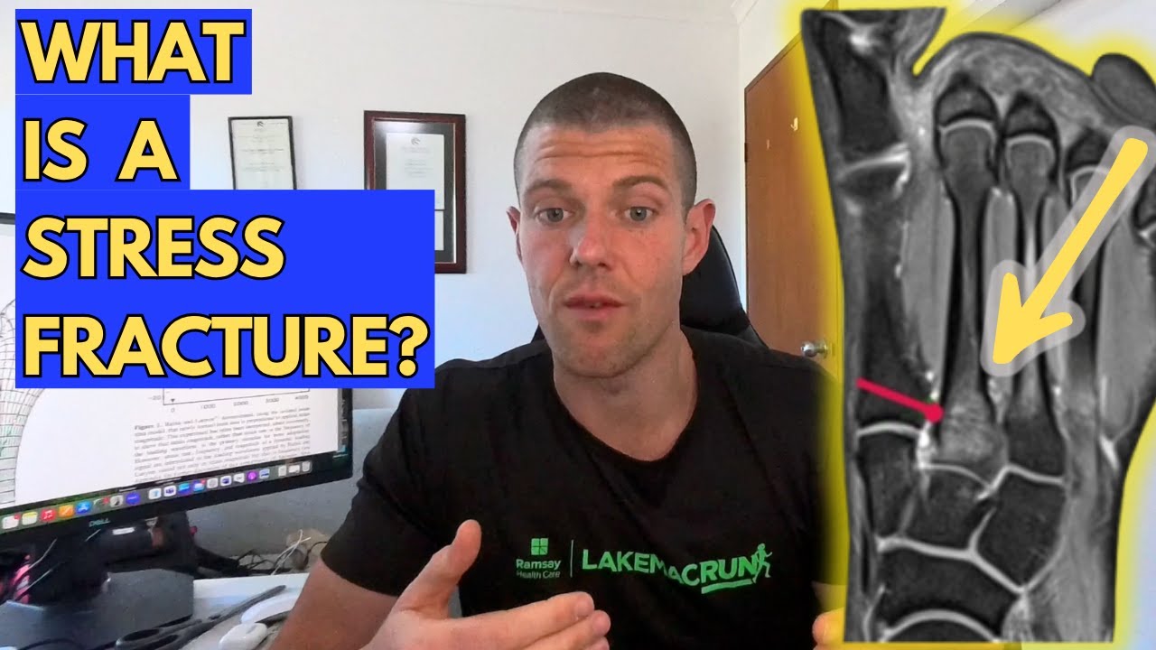 Stress Fractures in Runners | What They Are and Why They Matter