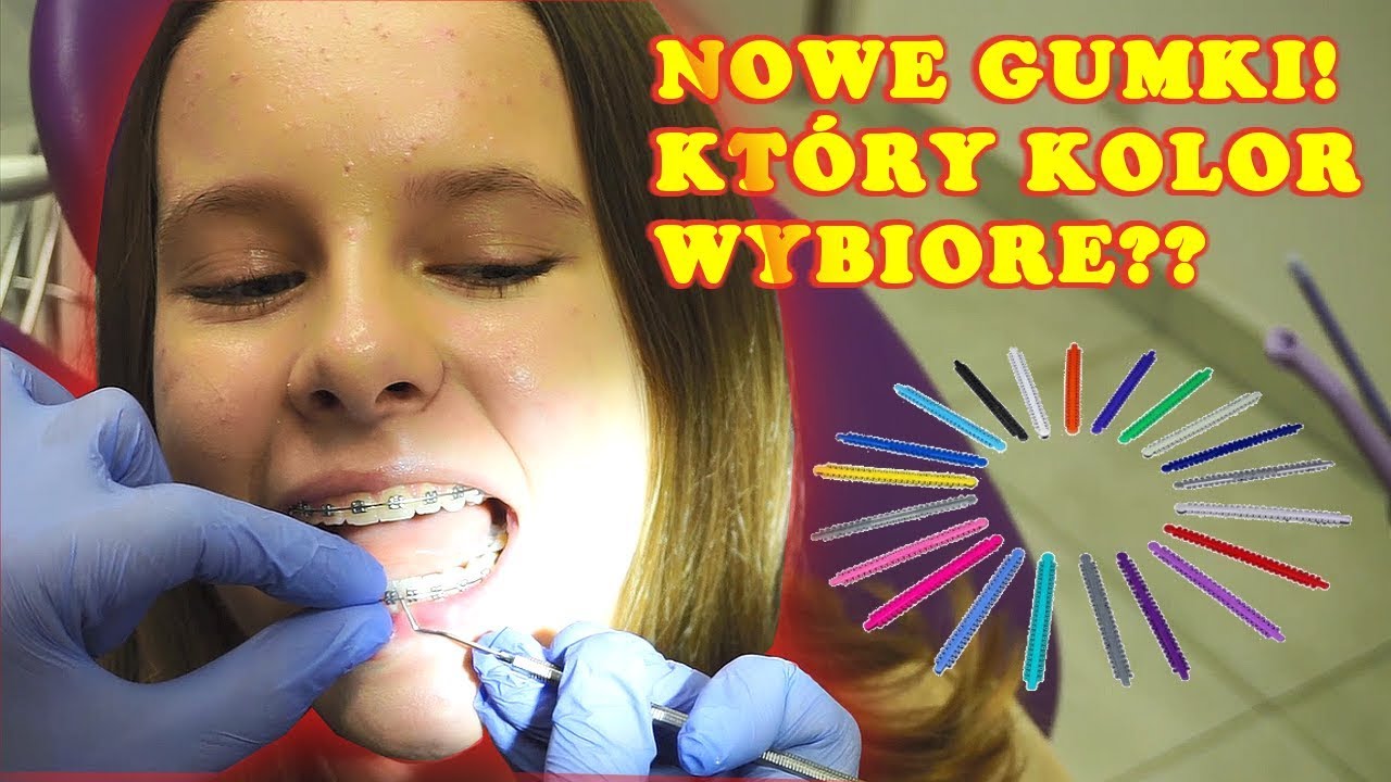 NOWE GUMKI W APARACIE NA ZĘBY 🤩 WIZYTA U ORTODONTY 😩 BOLAŁO? VLOG / AMELIE