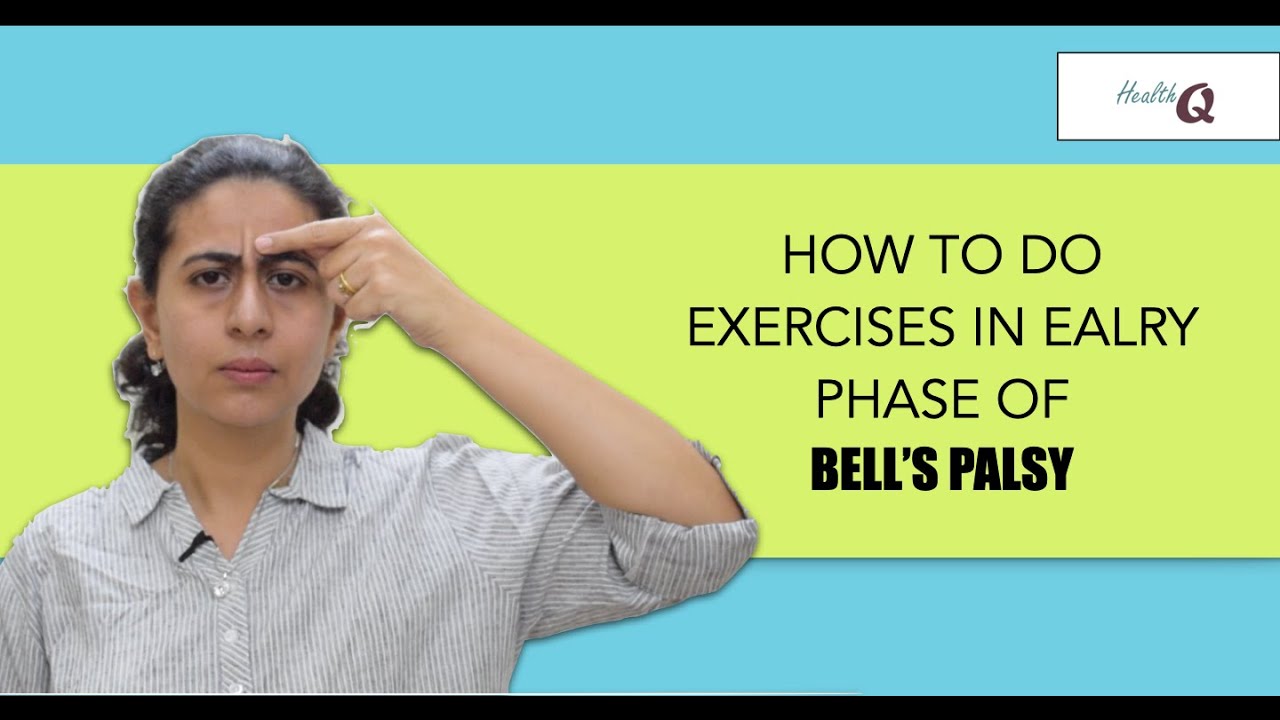 FACIAL EXERCISES IN EARLY PHASE OF BELL'S PALSY