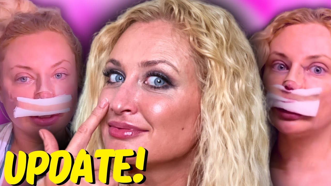 Natalie's SURGERY Obsession Is Getting WORSE! (90 Day Fiance Update)