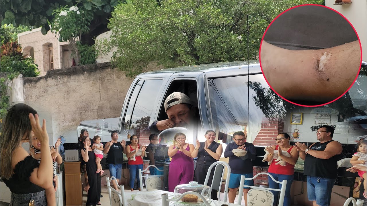 TIVE UM PEQUENO ACIDENTE, O DIA DEPOIS DO ANIVERSÁRIO 