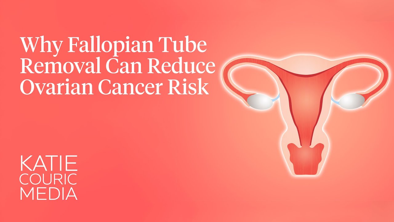 Why fallopian tube removal can reduce cancer risk