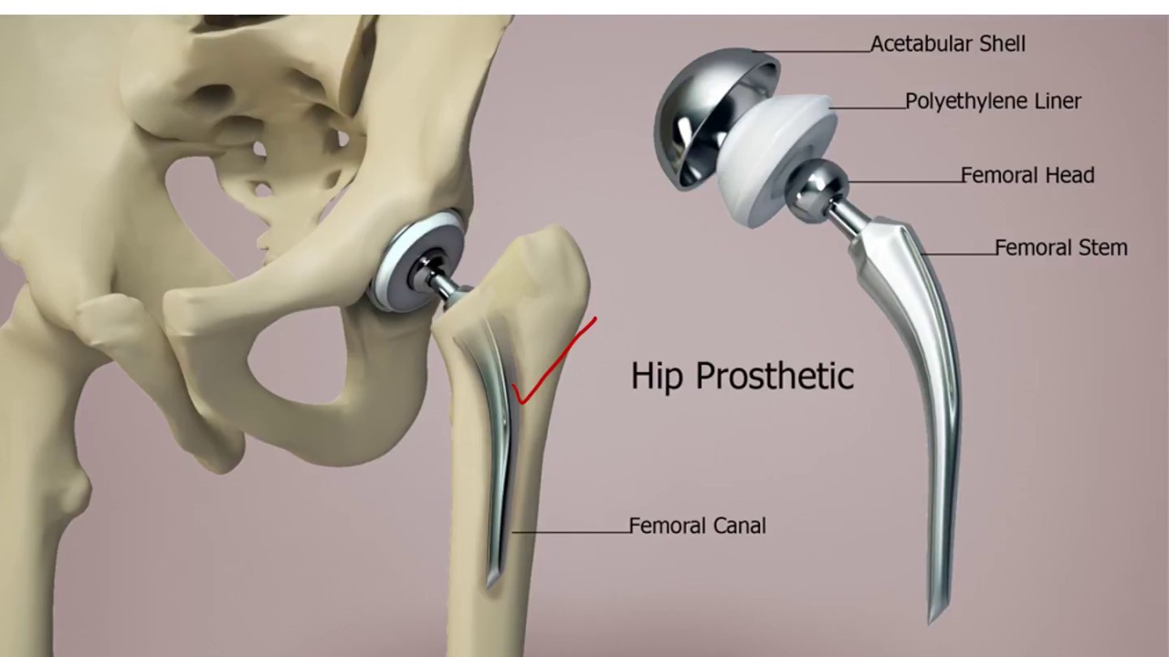 Orthopedics Instruments Video No 19