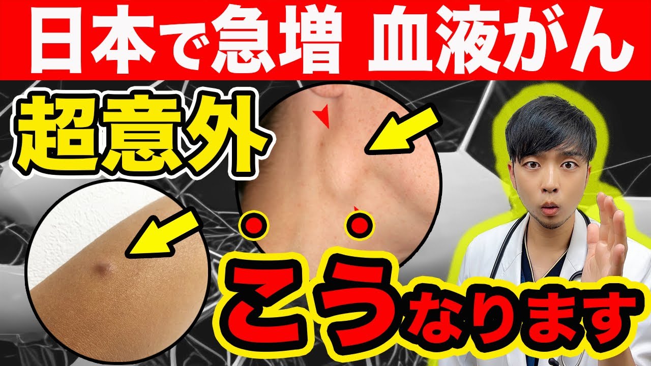 【なぜ報道されない?】日本で激増する血液がん『悪性リンパ腫』とは？【放置危険な『しこり』】リンパ系の真実