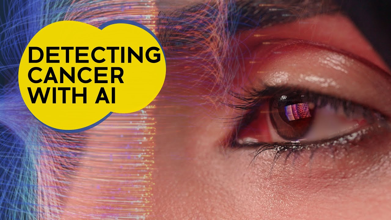 Detecting breast cancer with a blood test, using artificial intelligence