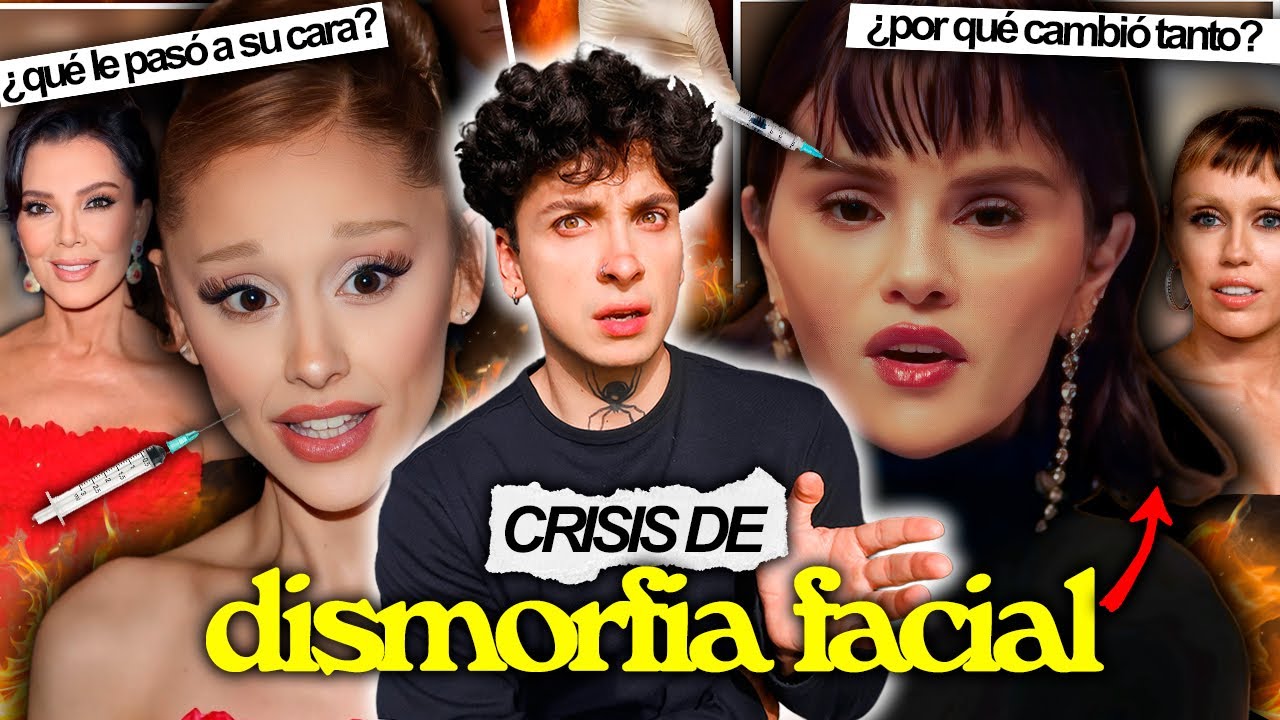 El aterrador auge de la DISMORFIA FACIAL: ya NADIE luce HUMANO...
