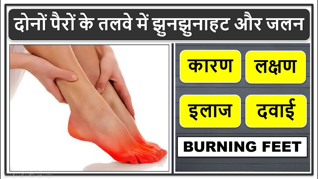 दोनों पैरों के तलवे में झुनझुनाहट और जलन क्यों होती है?, कारण, लक्षण, इलाज, दवाईयां, BURNING FEET,