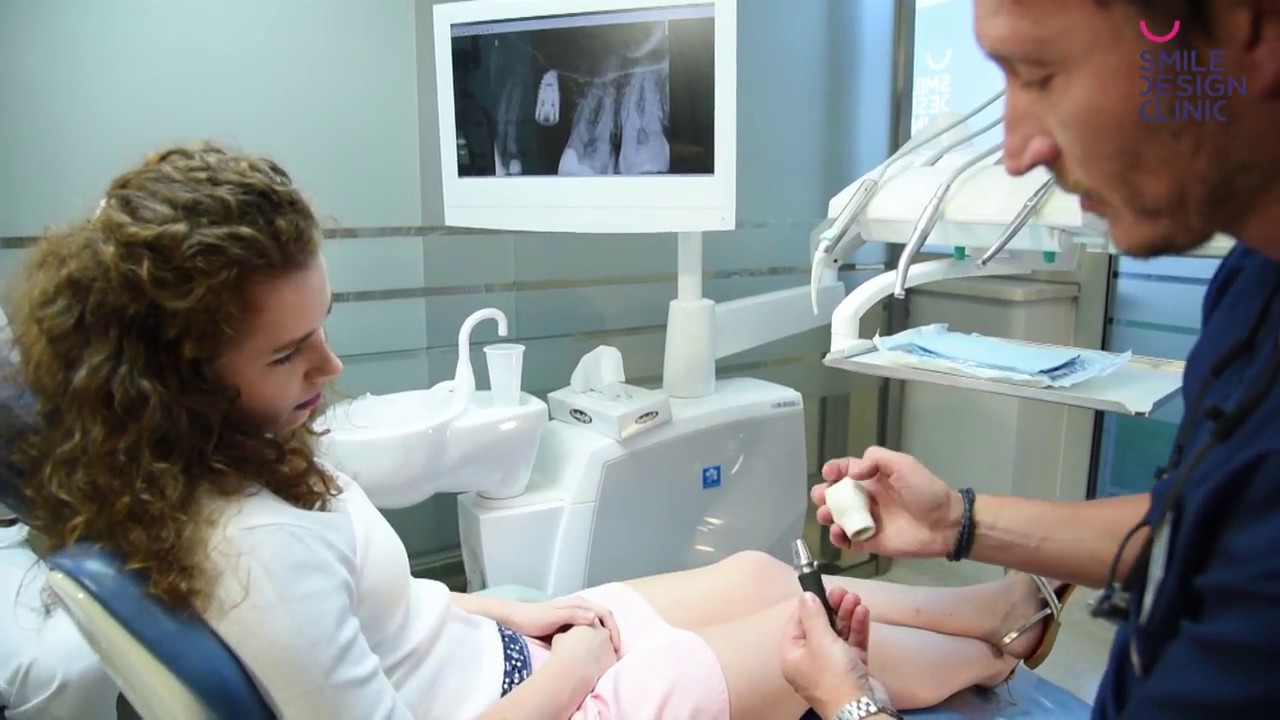 Implantologia - Smile Design Clinic | Warszawa