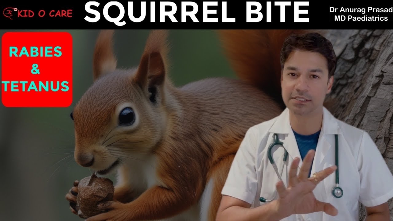 गिलहरी (Squirrel Bite) ने काटा: What Next | Rabies and Tetanus Vaccine Protocol by Dr Anurag Prasad