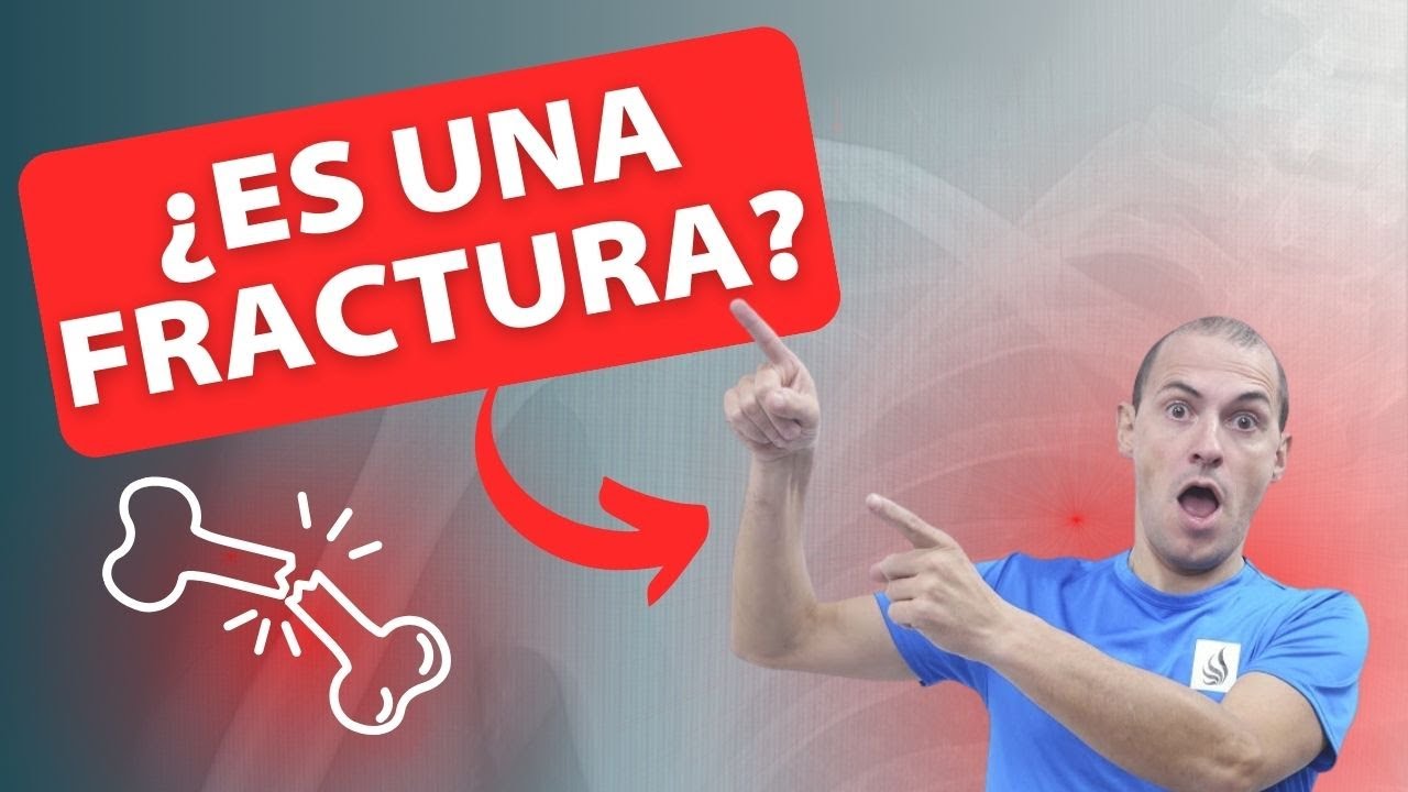 🤔Cómo saber si tengo una fractura osea o hueso roto🦴💥