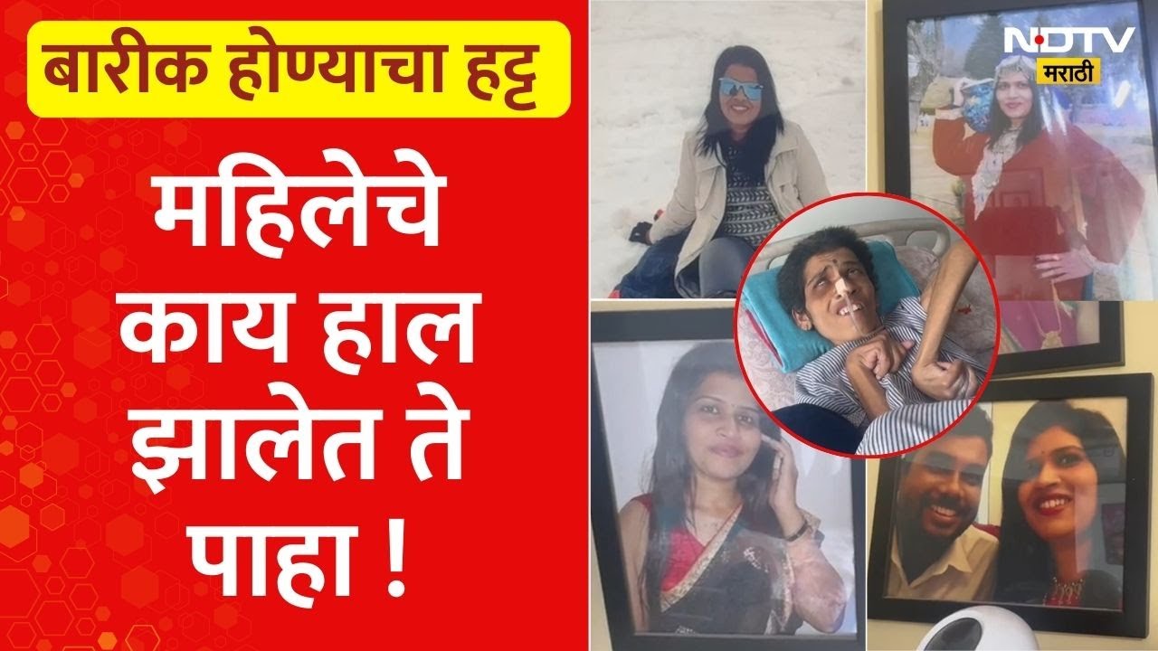 आयुष्य भरभरून जगण्याच्या स्वप्नांचा चक्काचूर, वजन कमी करण्याच्या शस्त्रक्रियेनंतर काय झालं पाहा...