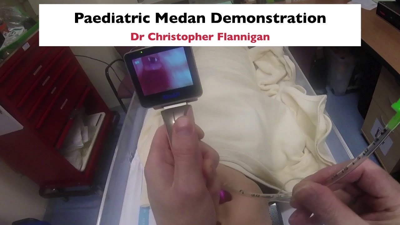 Paediatric Medan Video Laryngoscope Demonstration