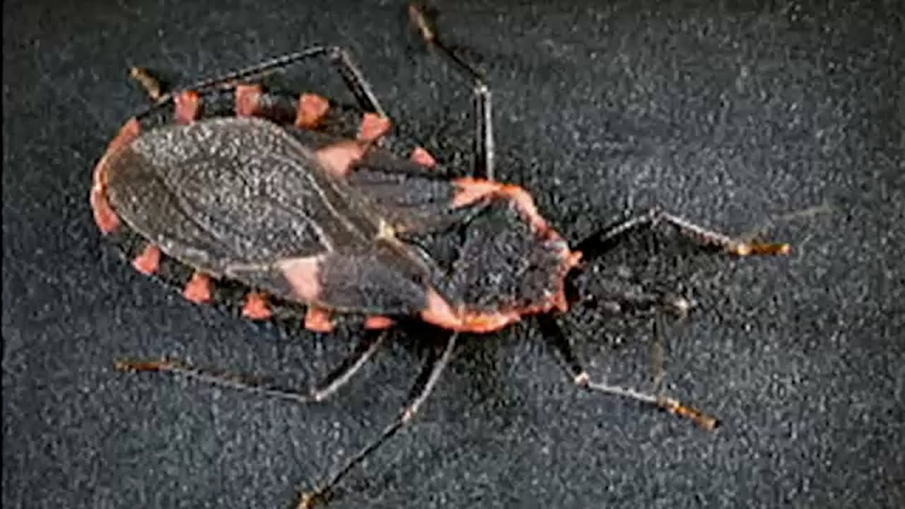 Chagas disease from 