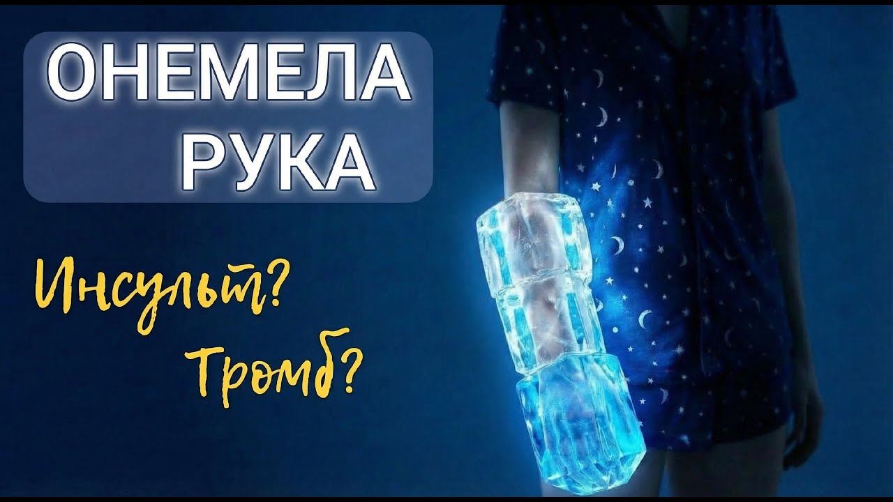 Немеют пальцы? Узнай ВСЕ ПРИЧИНЫ. Невролог объясняет