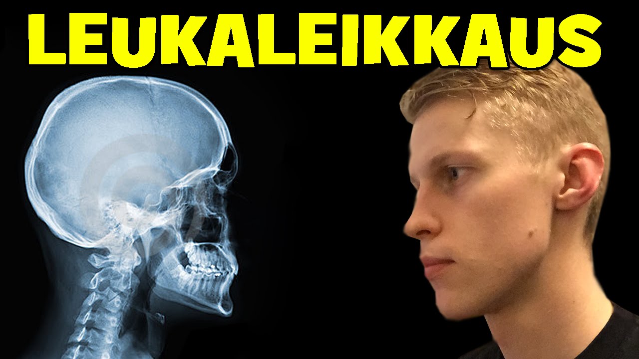 OLIN LEUKALEIKKAUKSESSA | 60 000 Tilaajan Spesiaali