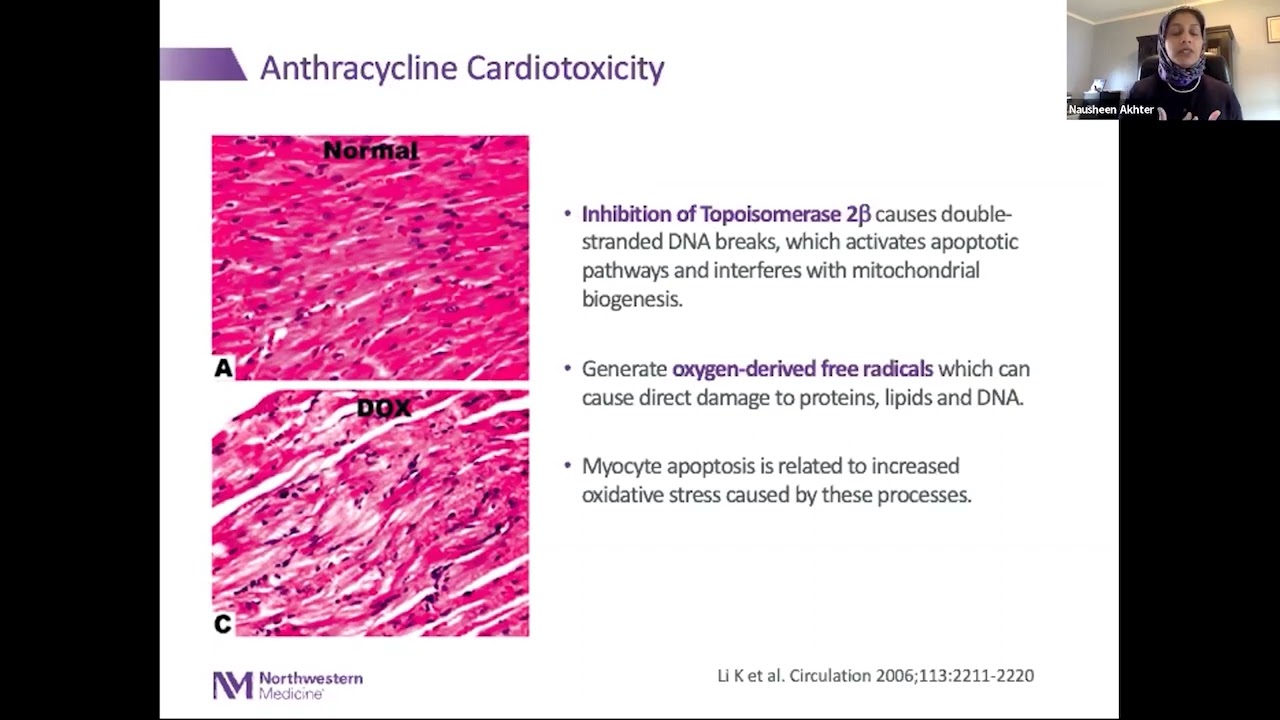Cardiac Toxicities of Breast Cancer Treatment: Pathophysiology, Prevention, and Treatment