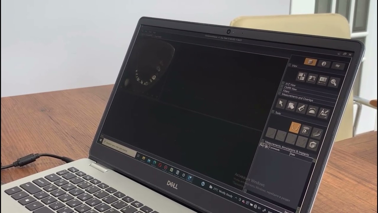 3D Dental (i-Dixel) | Инструкция по чтению рентген снимков | Рентген кескіндерін оқу -  нұсқаулық
