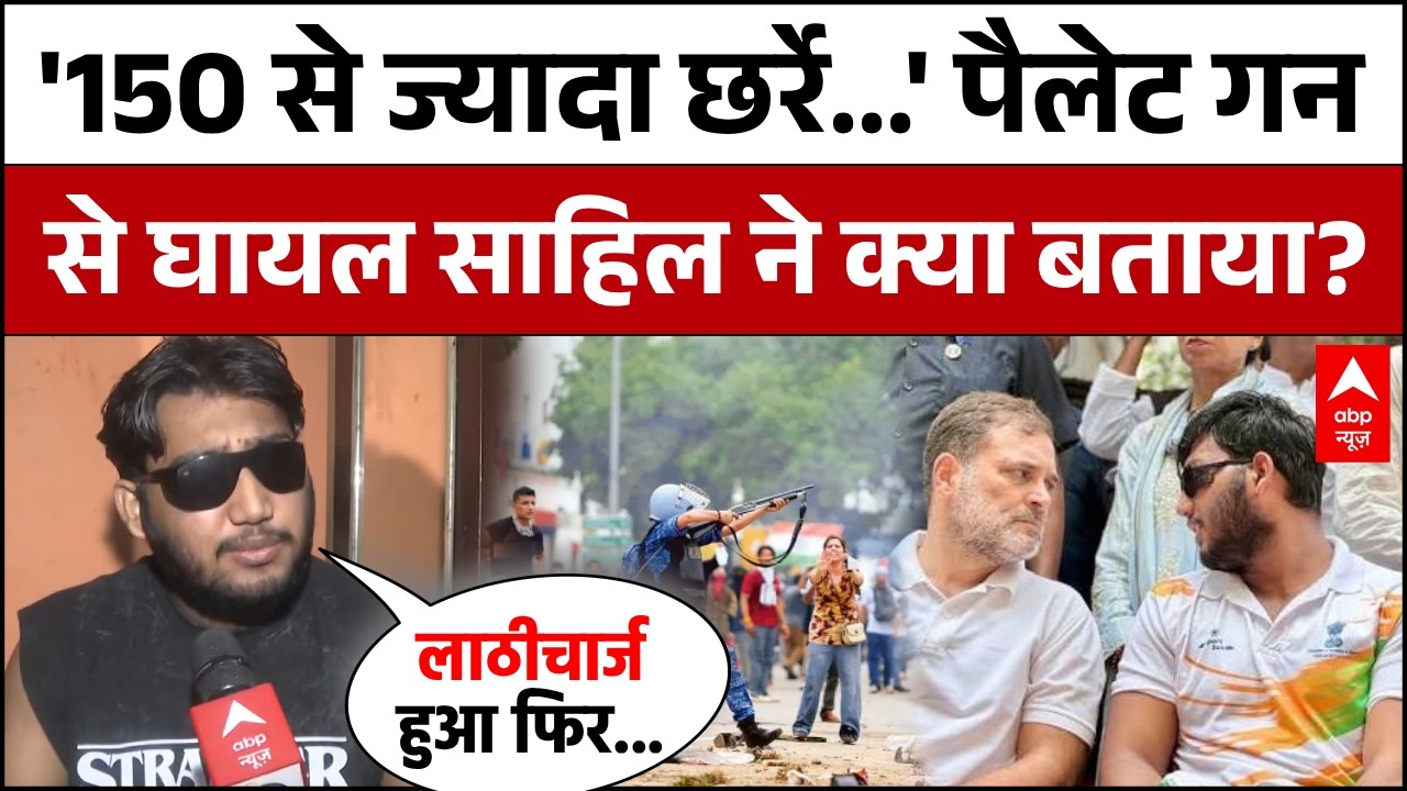 Pellet Gun Attack Story: 20 July को CJP Protest में Sahil के साथ क्या हुआ? पूरी सच्चाई! | Rahul