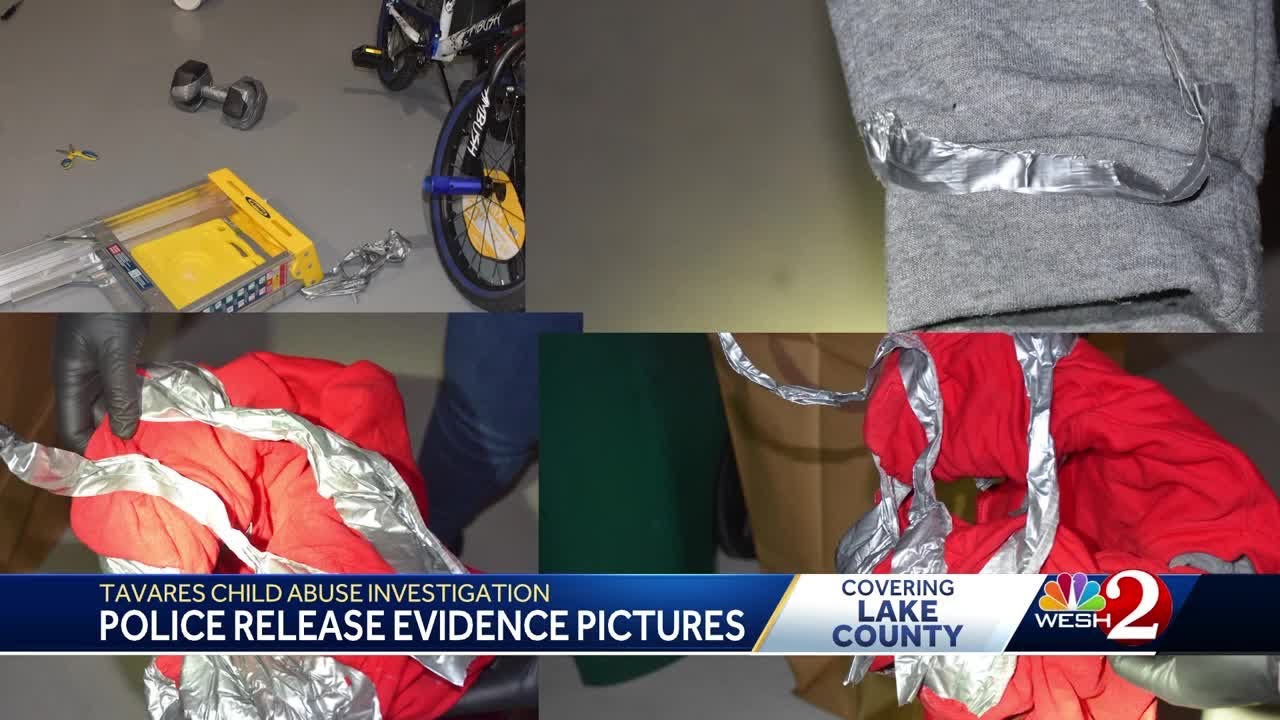 Police release photos of objects used in Tavares abuse case involving 10-year-old boy