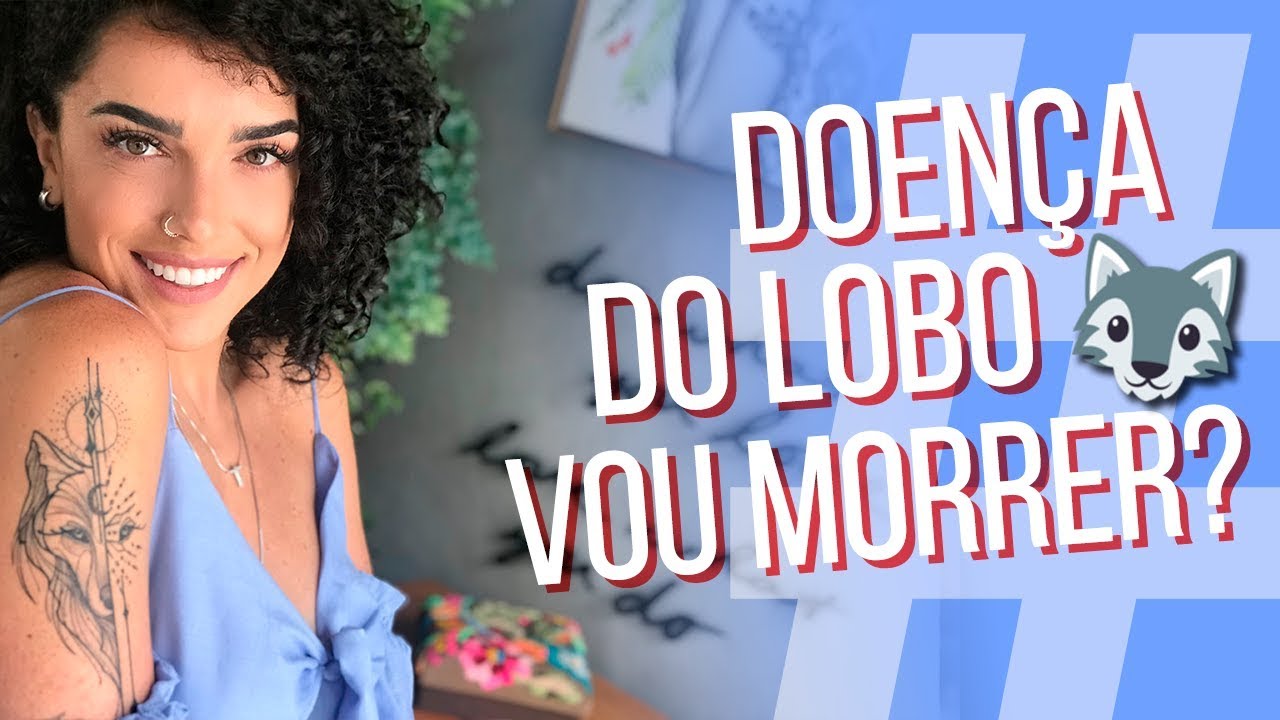 EU TENHO LÚPUS! | #VemkiTrem