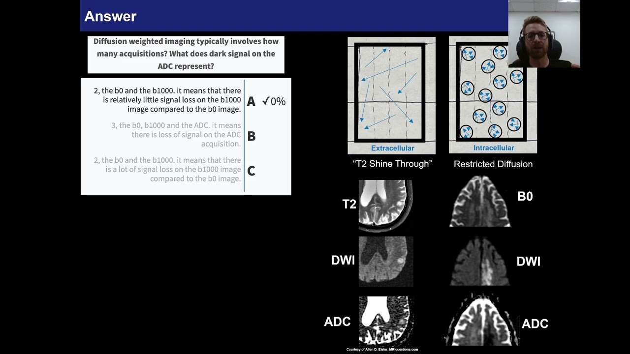 MRI Physics 3.4, DWI Question Review