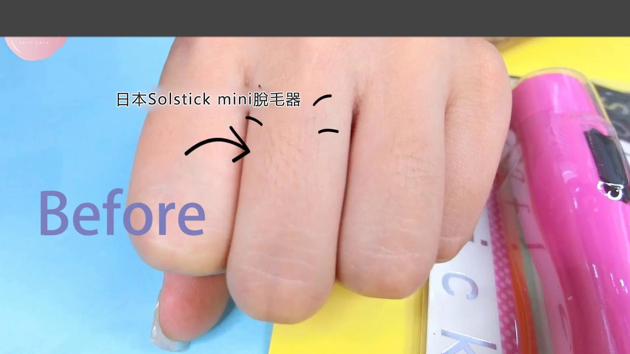 女人我最大推介 日本 solstick mini 脫毛器