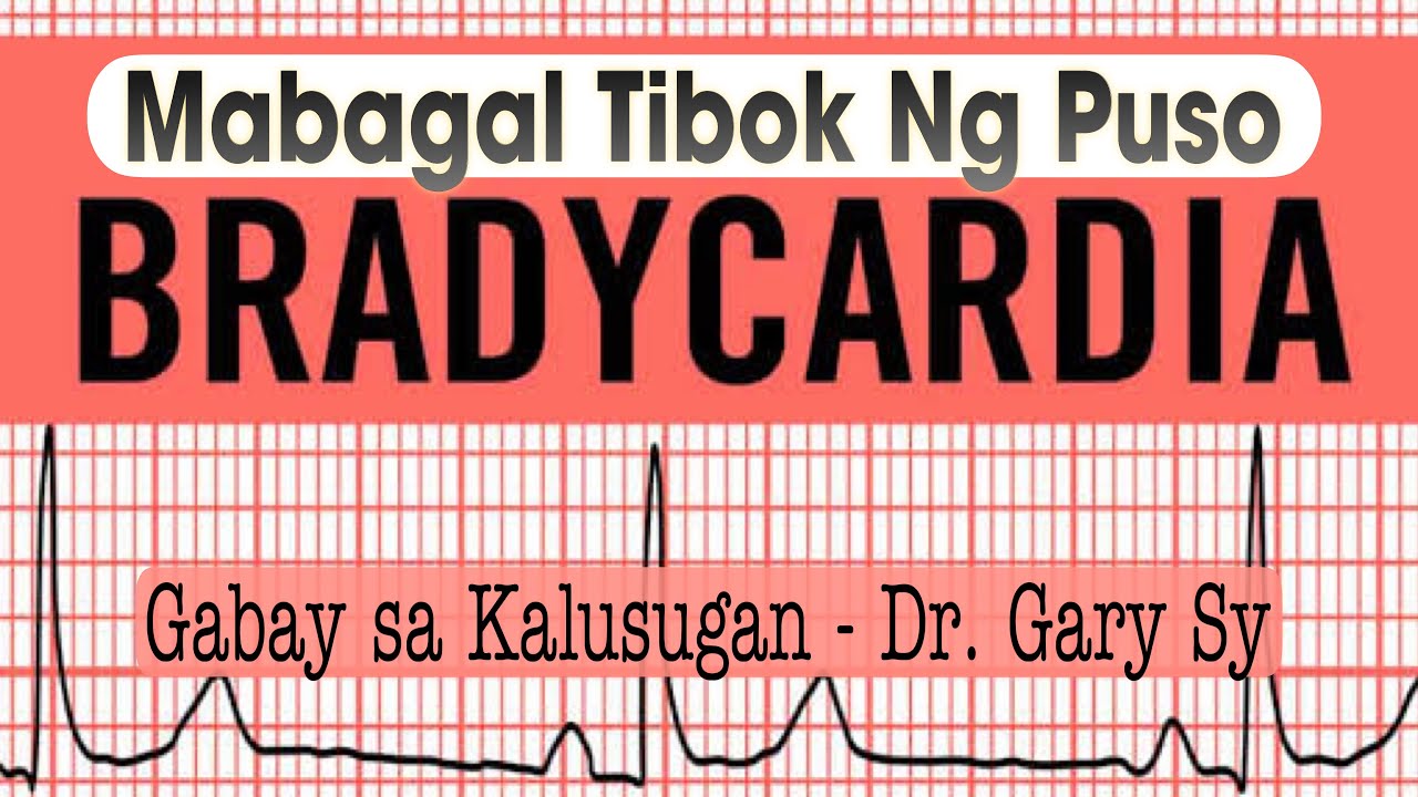 Bradycardia (Slow Heart Rate) - Dr. Gary Sy