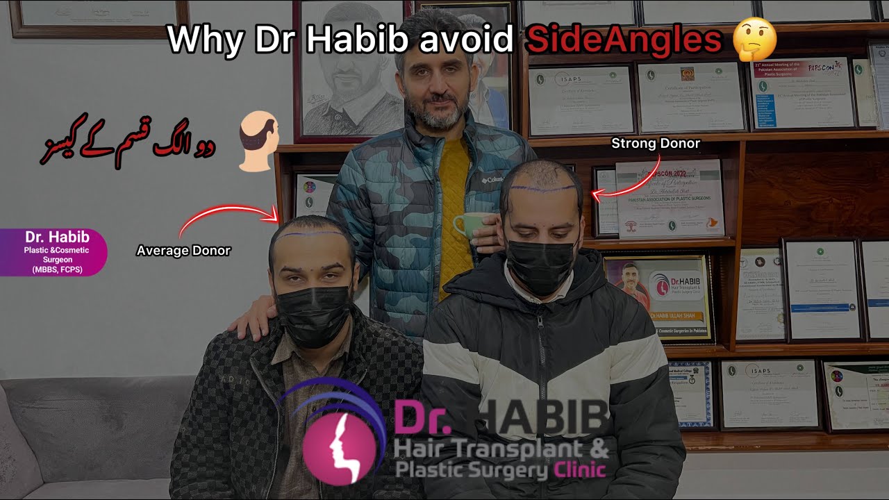 Why Dr. Habib avoid side angles🤔 | Dr. Habib explain 🧑🏻‍⚕️00923118800339