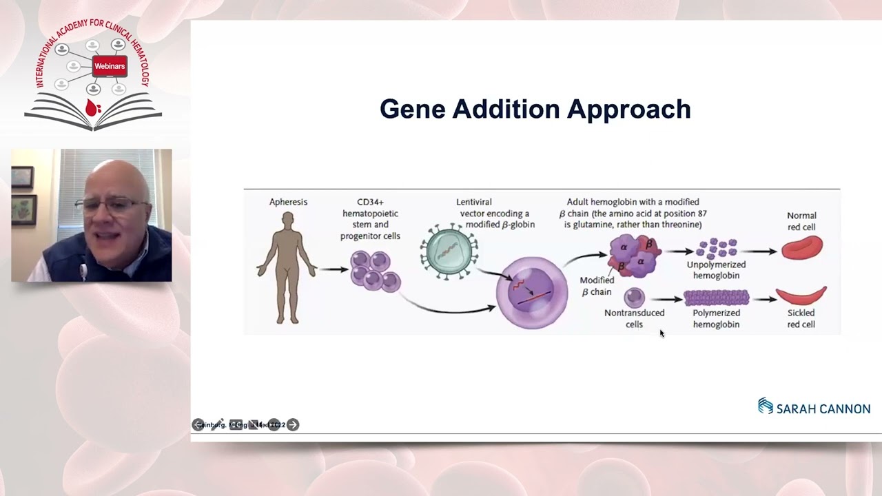 Gene therapy in hemoglobinopathies